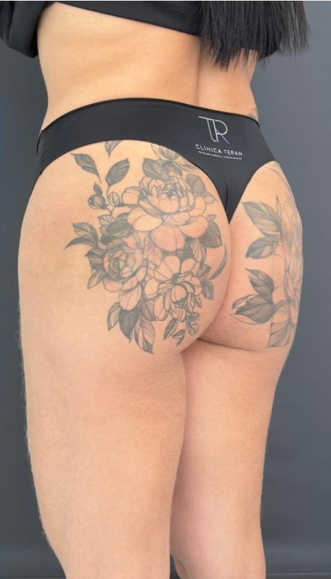 Depois: Antes e depois remodelação médica